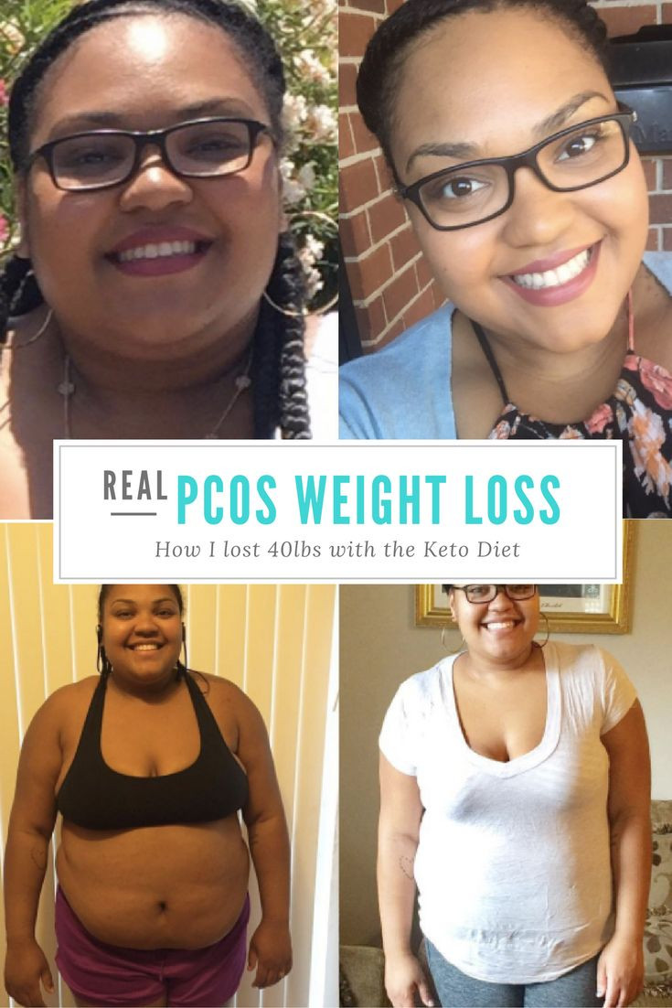 Keto Diet For Pcos
 Pin on Weight loss