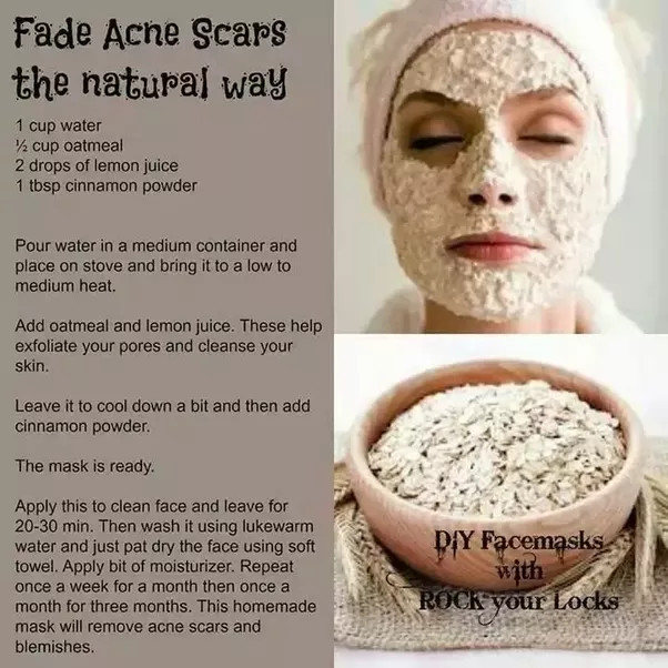 Acne DIY Face Mask
 What are the best DIY face masks for acne scars Quora