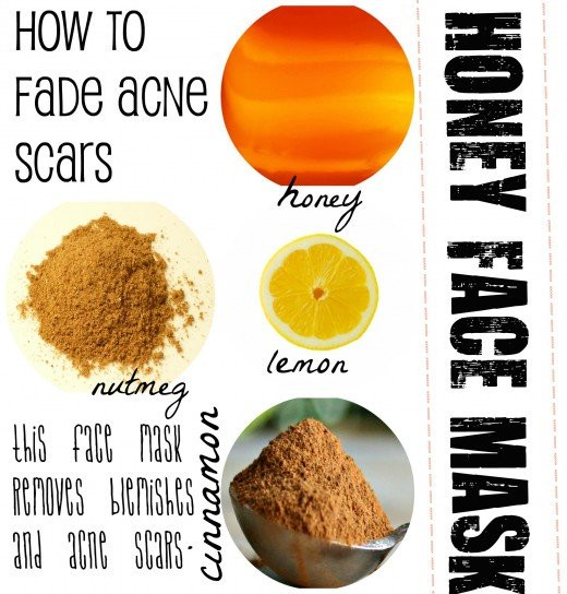 Acne DIY Face Mask
 DIY Facemask ALL NEW DIY FACE MASK FOR ACNE SCARS