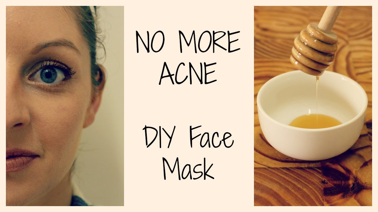 Acne DIY Face Mask
 HOW TO GET CLEAR ACNE FREE SKIN