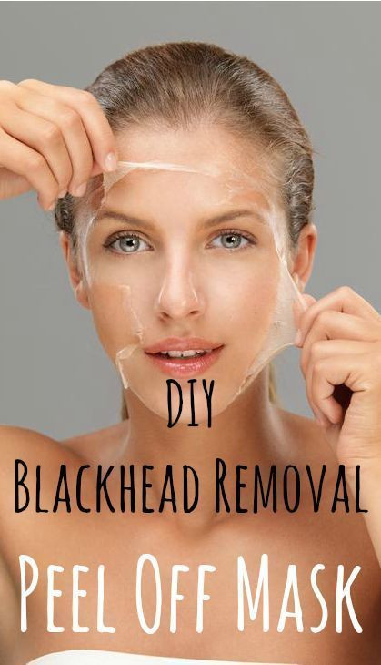 DIY Blackhead Removal Peel Off Mask
 Vingle Effective Blackhead Peel f Mask DIY Face Mask