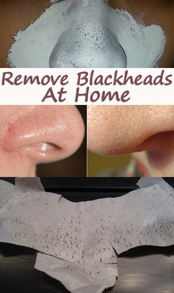 DIY Blackhead Remover Mask
 Homemade Blackheads Remover Tutorials and Ideas Hative