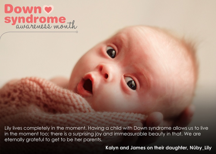 Gifts For Down Syndrome Child
 288 best images about Kids with Down syndrome and cute