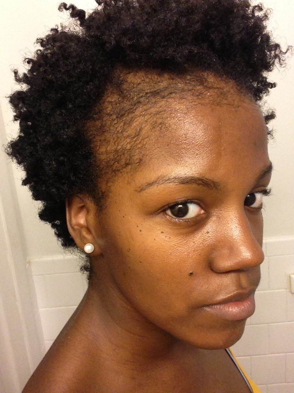 Natural Hairstyles For Thin Edges
 Natural Hair Thinning Edges