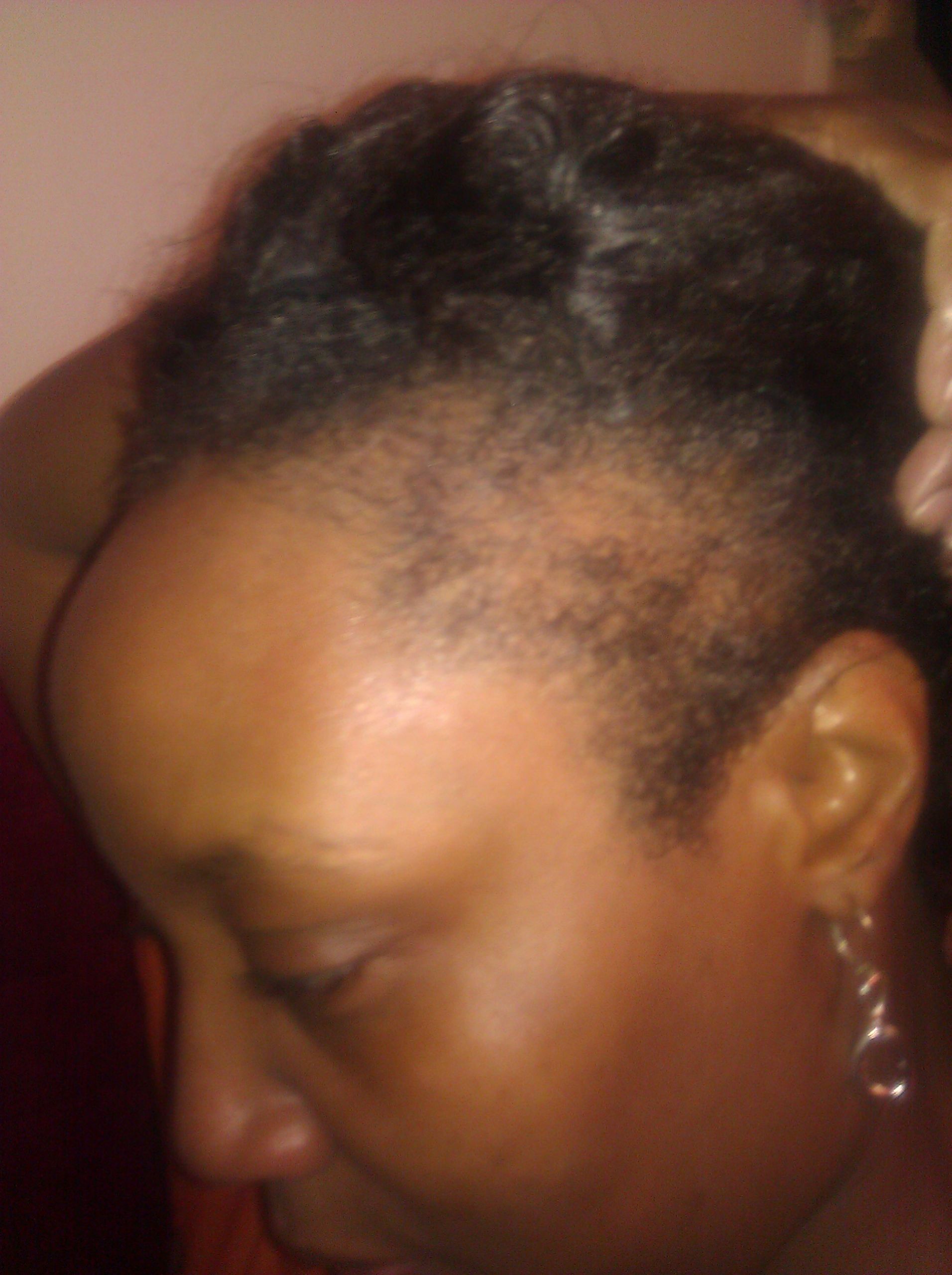 Natural Hairstyles For Thin Edges
 Beautiful Curls and Afros Natural Hair and Thinning Edges