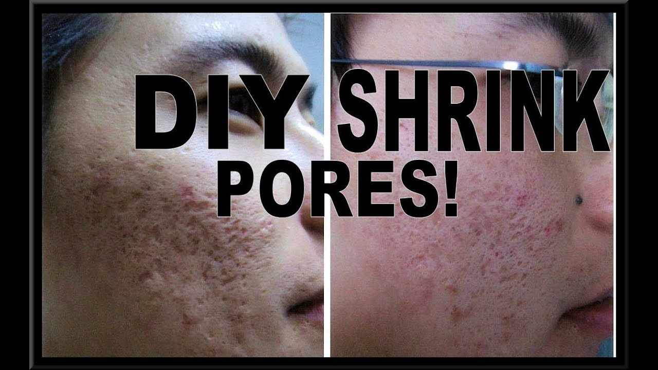 Pore Shrinking Mask DIY
 HOW TO SHRINK PORES DIY PORE MINIMIZING MASK
