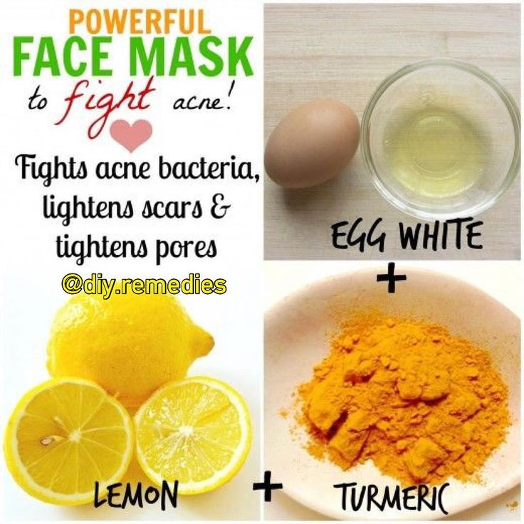 Pore Shrinking Mask DIY
 powerful face mask which fight bacteria and minimize pores